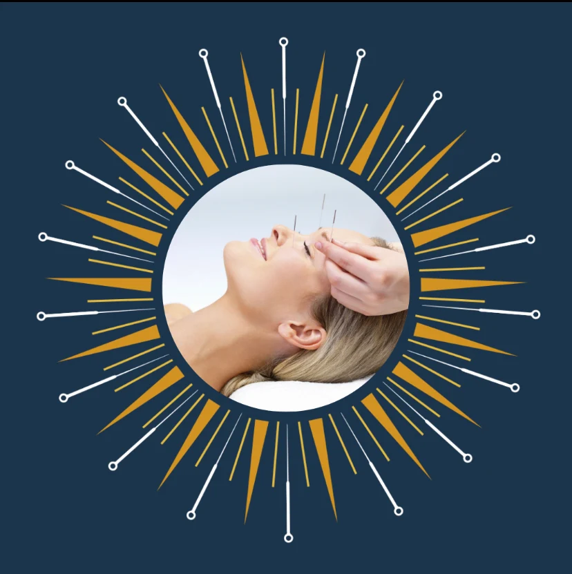 Amanda Nordell Acupuncture