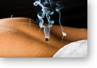Inner Light Acupuncture Dublin